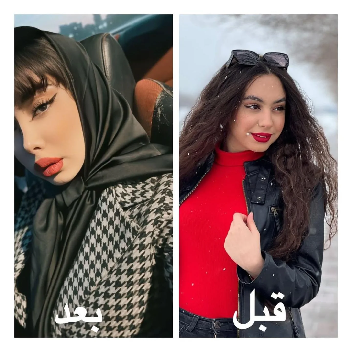 نمونه قبل و بعد جراحی بینی دکتر امیر سلمانی