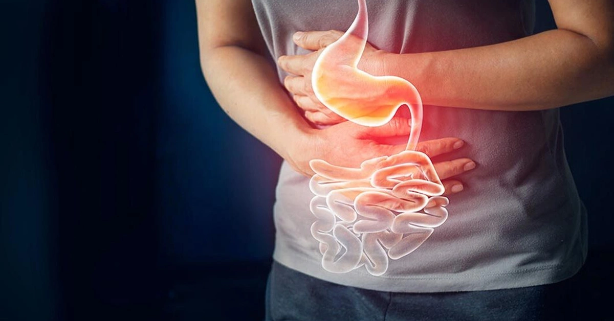 Stomach doctor - دکتر معده